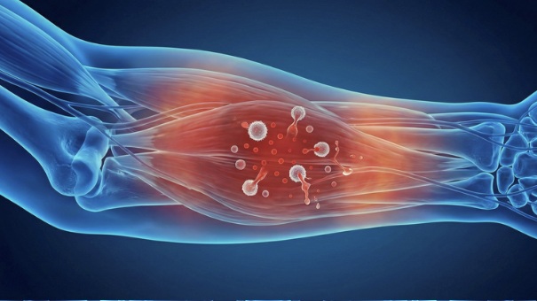 Infection and Inflammation Test